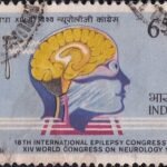Diagram of Human Brain and Percussion Hammer
