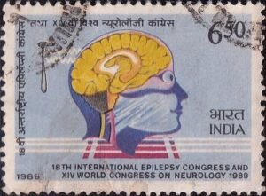Diagram of Human Brain and Percussion Hammer