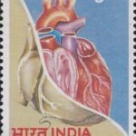 100 Years of Cardiac Surgery