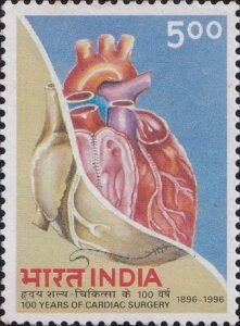 100 Years of Cardiac Surgery