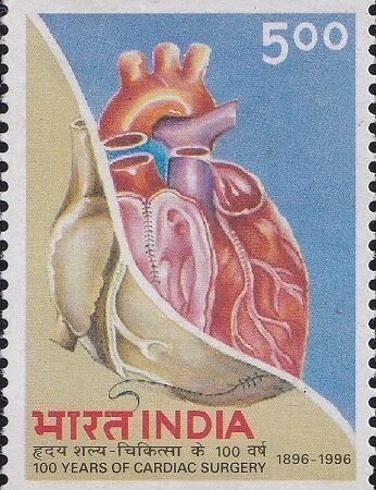 100 Years of Cardiac Surgery