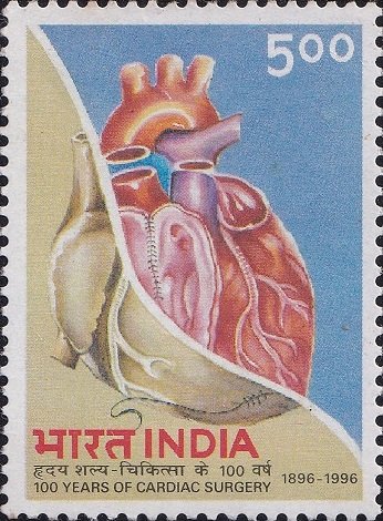 100 Years of Cardiac Surgery
