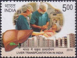 Liver Transplantation in India